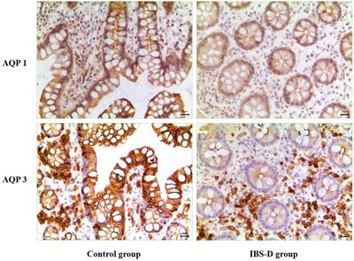 LncRNA H19 as a Competing Endogenous RNA to Regulate AQP Expression in the Intestinal Barrier of IBS-D Patients